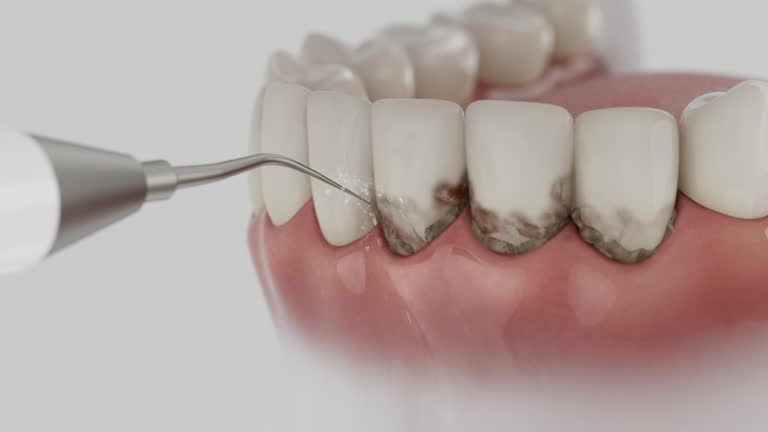 Reliable Dental contractor in Richwood, OH by Dentist Open Now